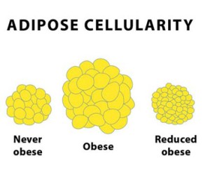 Once you have a certain amount of fat cells, they can only shrink in size -- never disappear. 