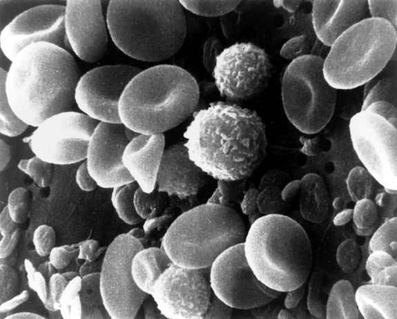 Cells, man. Food affects them greatly. 