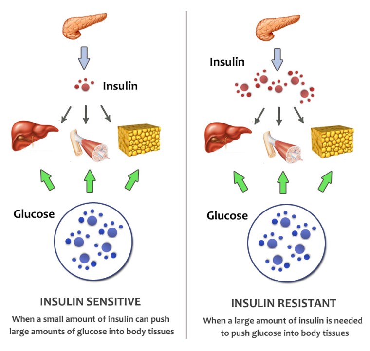 When you are insulin resistant, it has many negative implications. For one, you have higher blood glucose because the glucose can't get into the cells to be used/stored as energy and this is not good for metabolism. Also, your pancreas get stressed out, inflammation increases and you're unlikely to be in a state of potential fat burning. We want to put our body into a good metabolic state. 